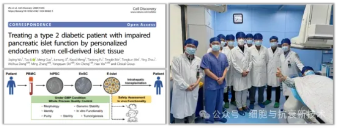 干細(xì)胞來(lái)源的自體再生胰島移植